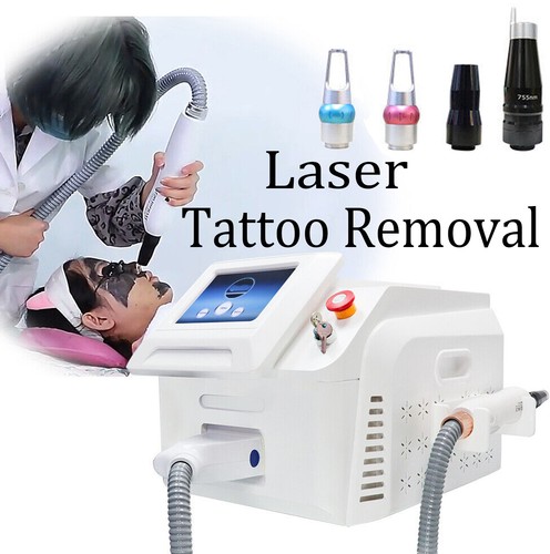 Yag rimozione tatuaggi - nd,