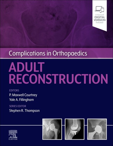 Complications orthopaedics - complications, in