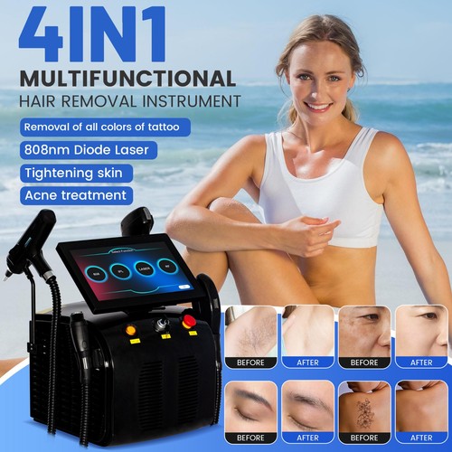 Depilazione laser diodi in - depilazione,