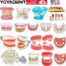 Modello denti dentali USA