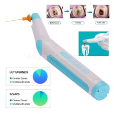 Dentista Endodonzia Endo Ultra