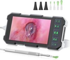 Video Otoscopio con Fotocamera