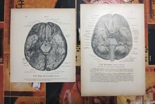 Lotto 3 Stampe Anatomiche Mediche encefalo Werner Spalteholz Vintage
