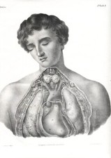 ARTERIE, LOTTO DI 5  BELLE  LITOGRAFIE ANATOMICHE 1840 ca.