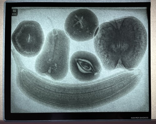 Ray radiografia arte un - -,