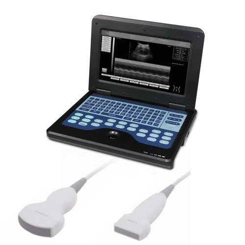 Scanner ultrasuoni portatile - ultrasuoni,