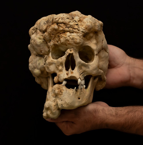 Joseph merrick skull replica - merrick,