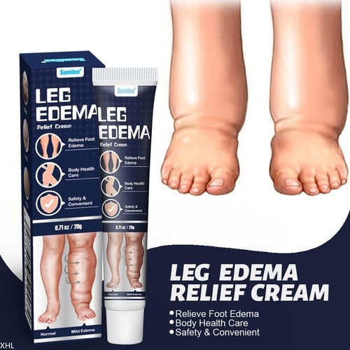 Crema anti edema gonfiore