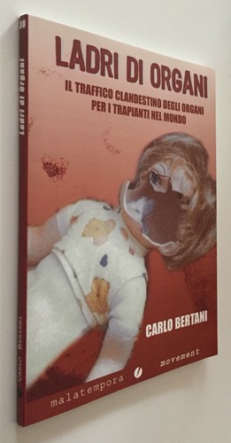 Bertani ladri organi il - ladri,