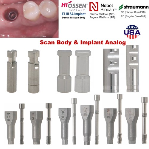 Cad cam implant scan - implant, body