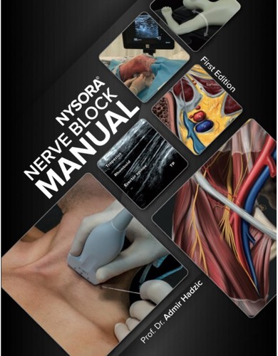 Nysora nerve block manual - nysora,