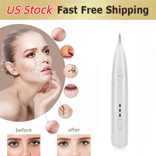 Penna plasma laser - al,