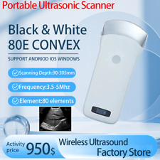 Sonda convessa ultrasuoni wireless 3,5/5 mhz 80 elementi scanner macchina portatile