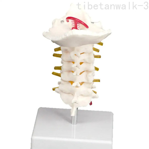 Arteria spinale occipitale