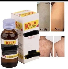 Kela Lozione 60ml Antiprurito Sollievo per Psoriasi Secca