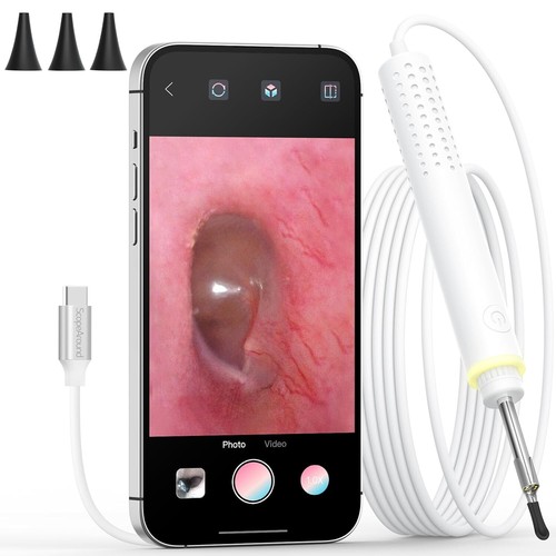 Scopearound otoscopio mm - 3,9,