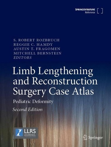 Limb lengthening and - limb,