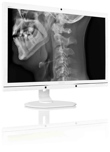 Monitor medico philips - monitor, 27"