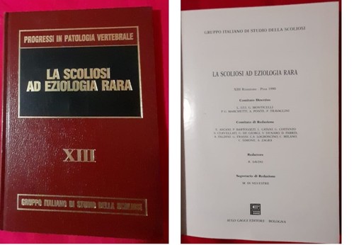 Scoliosi eziologia rara - scoliosi,