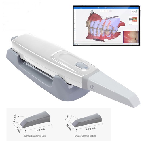 Scanner intraorale dentale