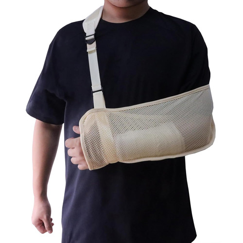 Mesh tutore braccio ingessato - braccio,