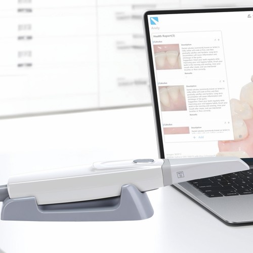 Nuovo scanner intraorale - scanner,