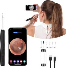 Otoscopio Digitale Wifi