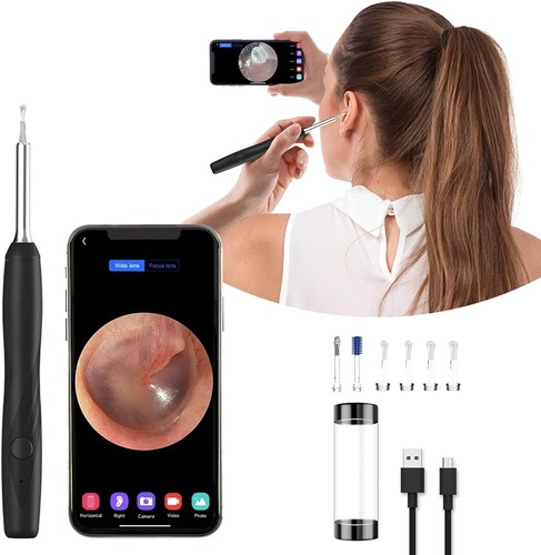 Otoscopio digitale wifi - otoscopio,