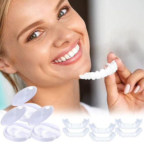 Faccette denti cosmetici - faccette,