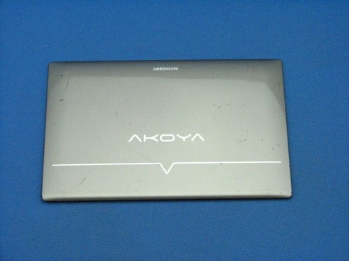 Coperchio display medion akoya - coperchio,