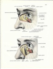 Stampa antica OCULISTICA