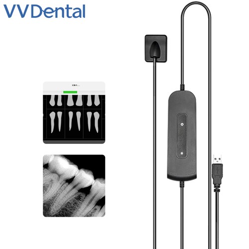 Sensore digitale dentale