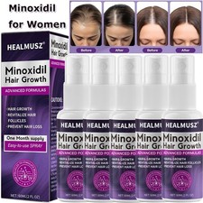 3/5x Minoxidil 2% per donna