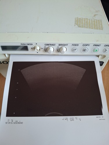 Stampante sony professionale - stampante,