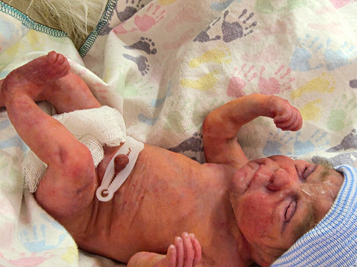 Micro preemie full body - preemie,