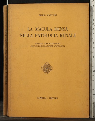 Macula densa nella - macula,