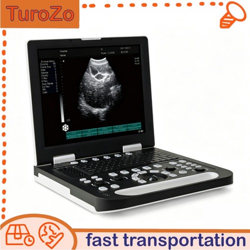 Scanner ultrasuoni doppler - scanner,