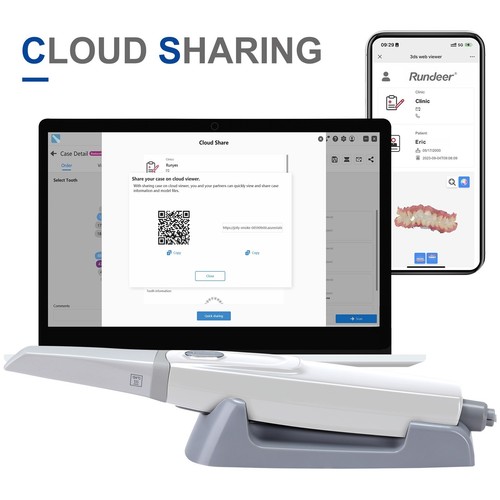 Scanner intraorale dentale - scanner,