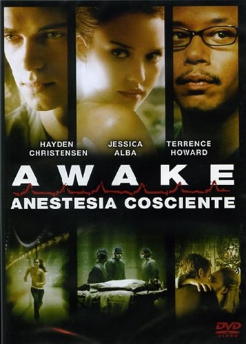 Dvd awake anestesia - dvd, cosciente