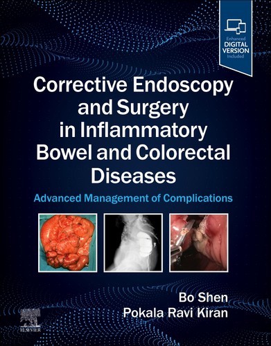 Corrective endoscopy and - endoscopy,