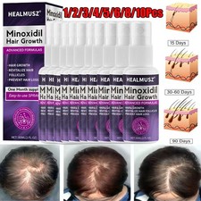 10/8pz Minoxidil 2% per Donna