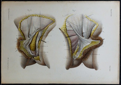 1866 vulva grandi - labbra,