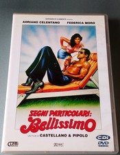 Dvd Segni Particolari