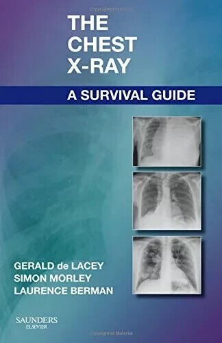 The chest ray a - x-ray:, survival