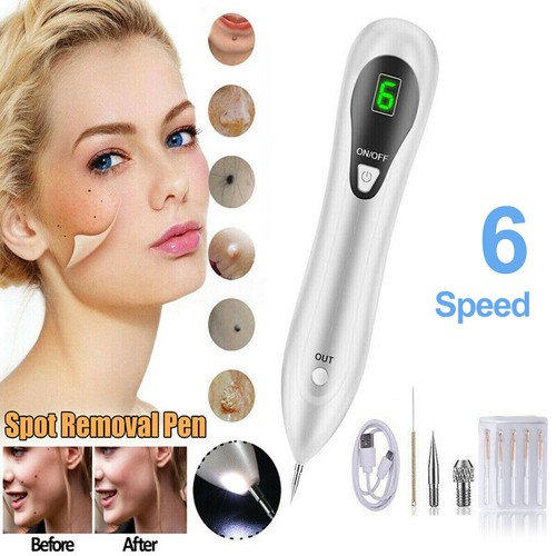 Penna laser plasma - al,