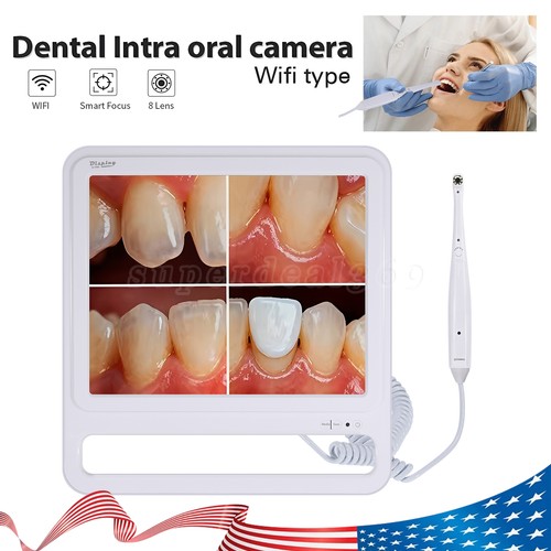 Telecamera intraorale dentale