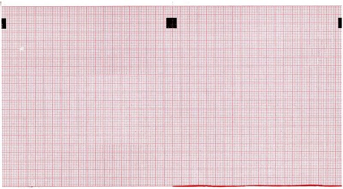 Carta ecg 112mm 100mm - ecg, x