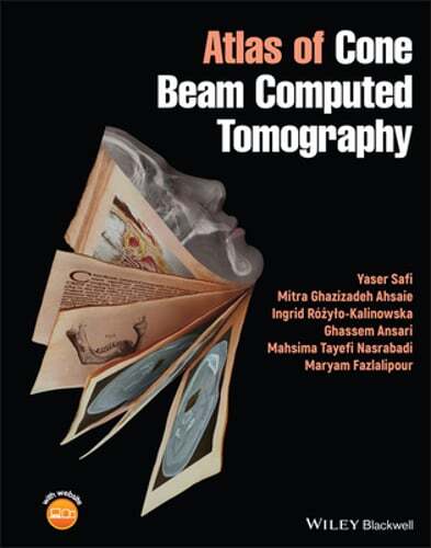 Atlas cone beam computed - atlas,