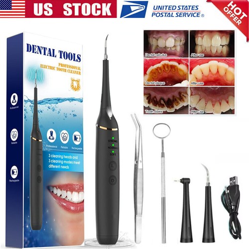 Pulitore dentale ultrasuoni - pulitore,
