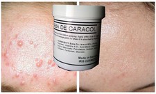 CREMA VISO BAVA DI LUMACA